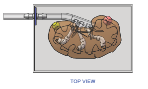 FIGURE2-LIVER-TOP-VIEW