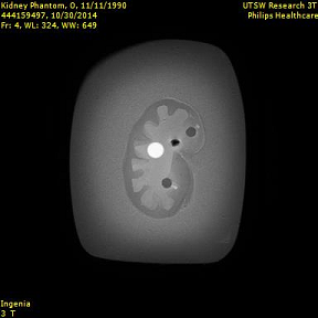 MRI Image 1