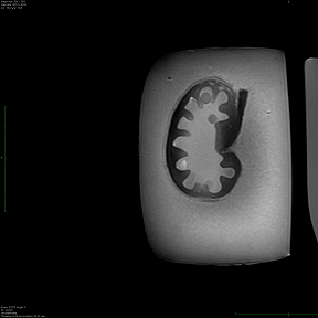 MRI Image 2