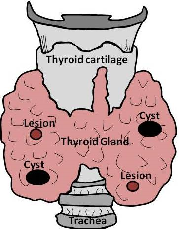 Thyroid Phantom schema