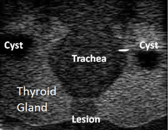 Ultrasound image of the thyroid phantom